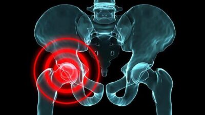 Hip Pain During Squats: The Ultimate Guide