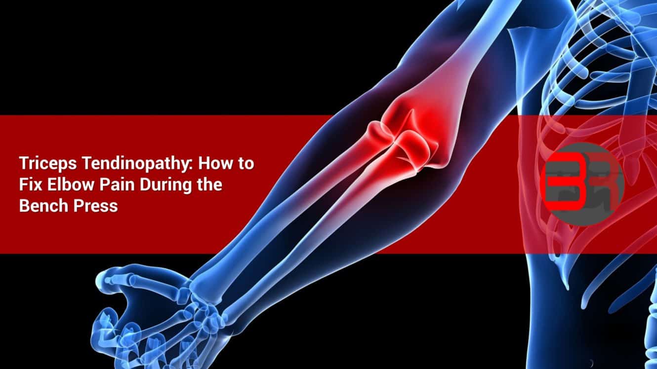 Triceps Tendinopathy How to Fix Elbow Pain During the Bench Press