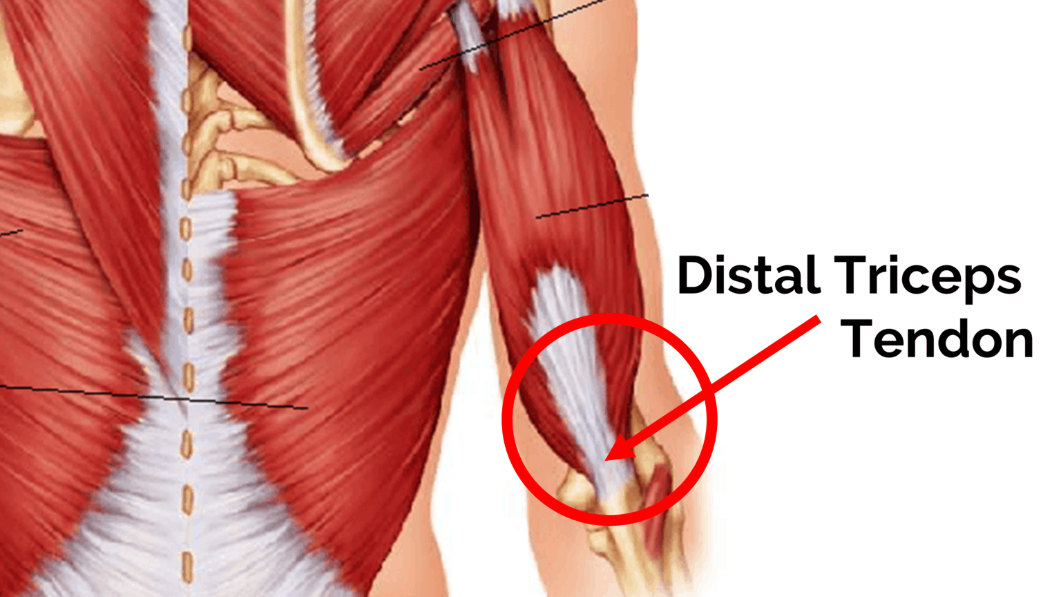 Triceps Tendon Barbell Rehab Triceps Tendon Barbell Rehab
