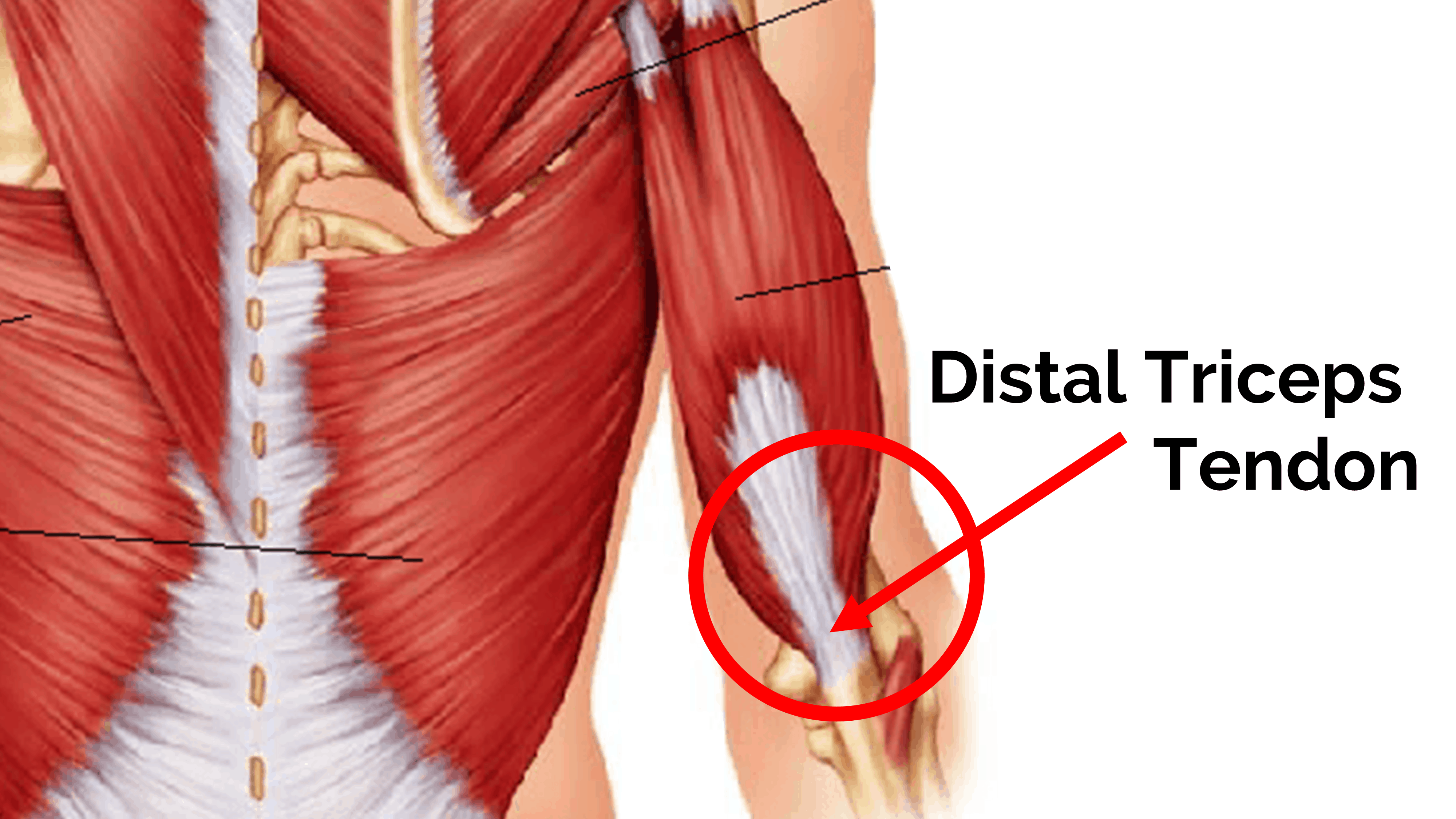 Triceps Tendon Barbell Rehab